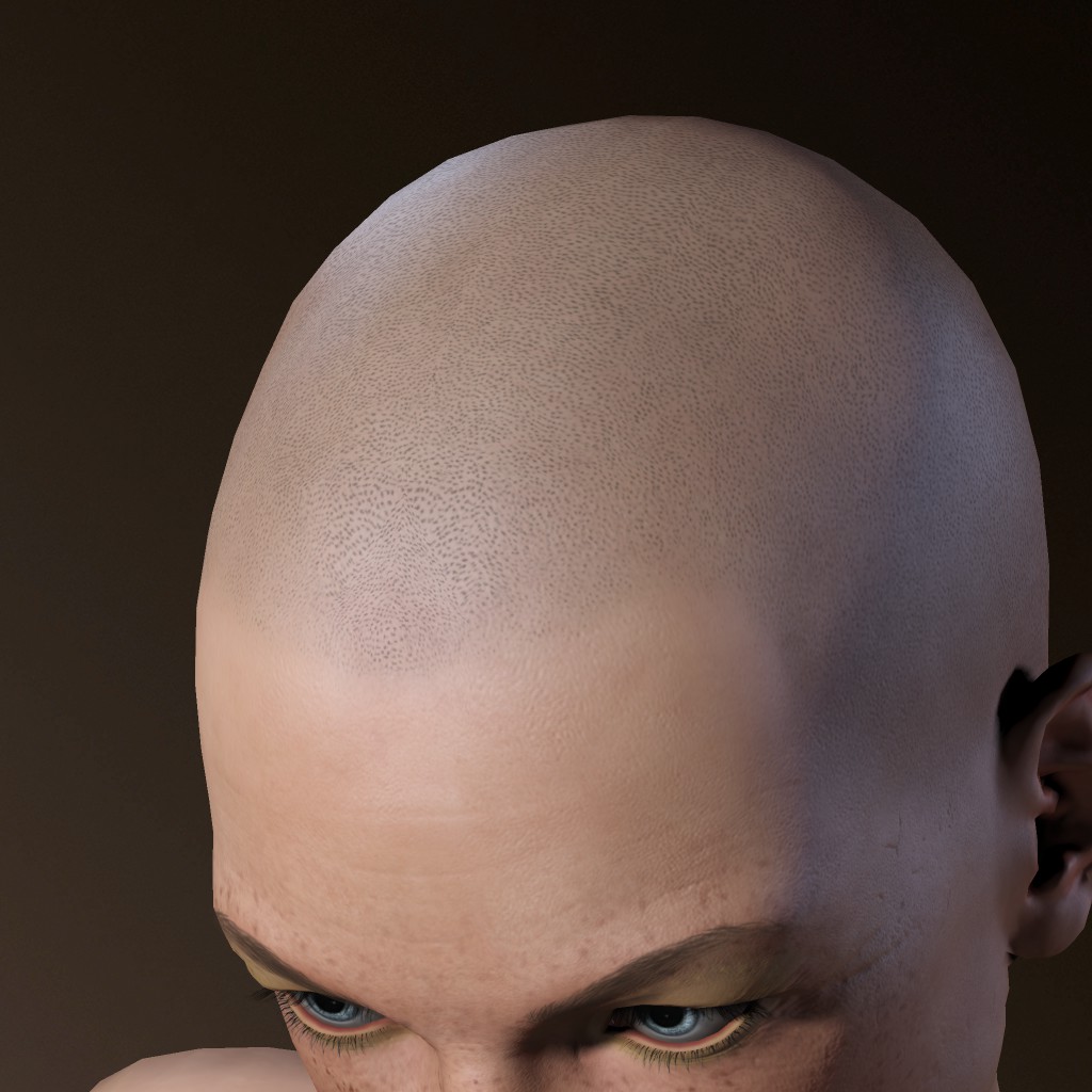 thisperson isbald